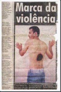 Rapaz curado extratérrestrês
