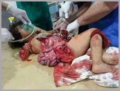 Pt dilma crianças palestinas